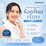 ร้อยไหมเรียบ (Smooth Thread Lift)